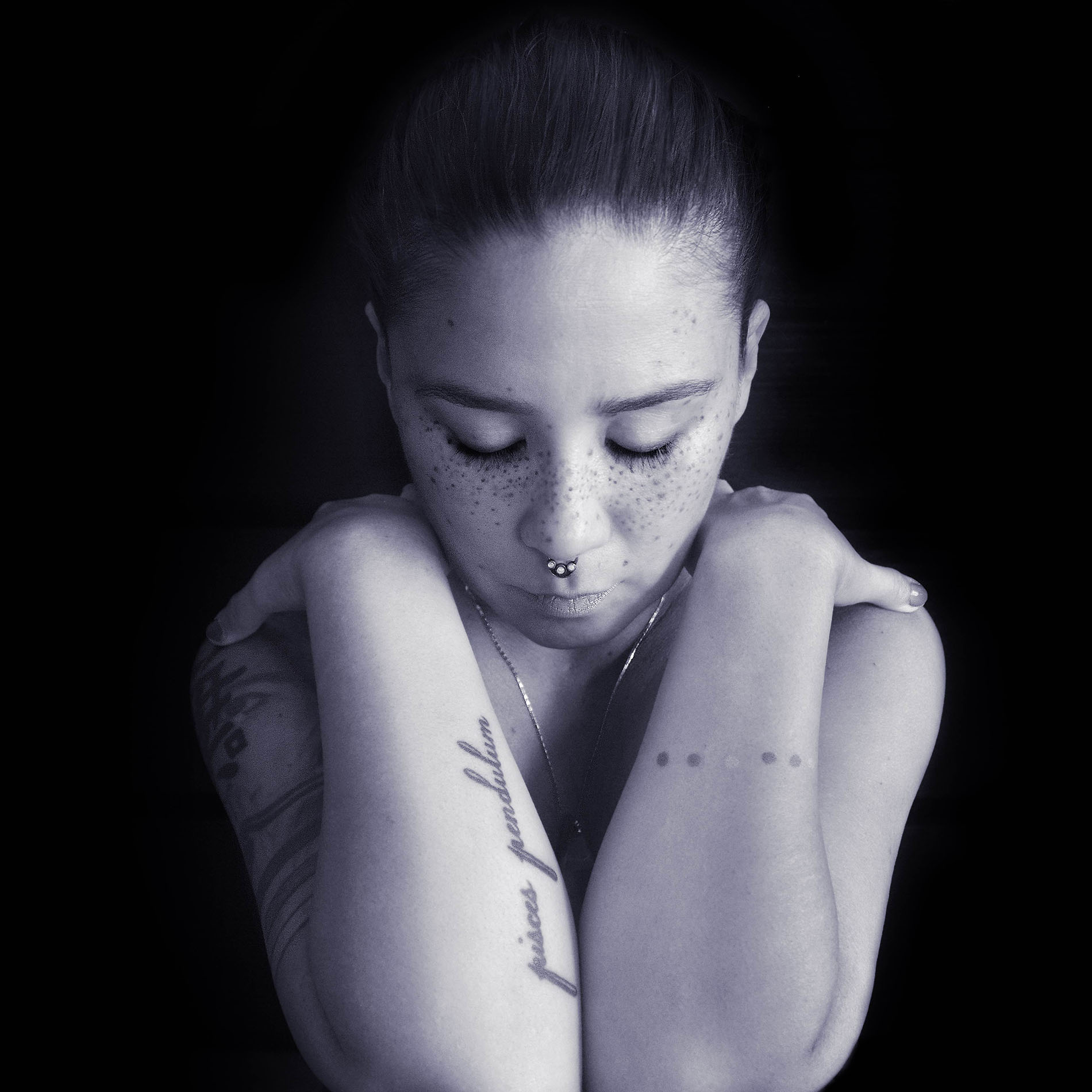 VEDA pre surgery BNW